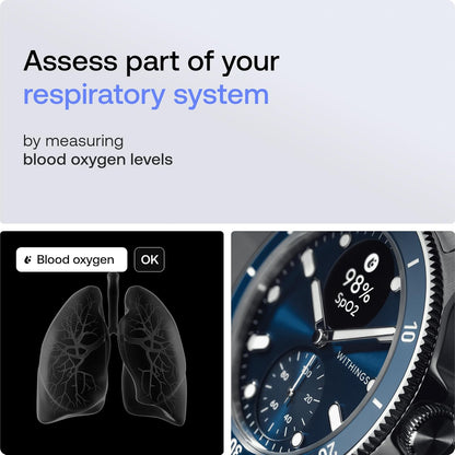 Scanwatch Nova - Heart Health Hybrid Smart Watch for Men & Women - SPO2, Temperature Monitoring, Sleep, Respiratory Health, Cycle Monitoring, 30-Day Battery Life, Apple Ios/Android